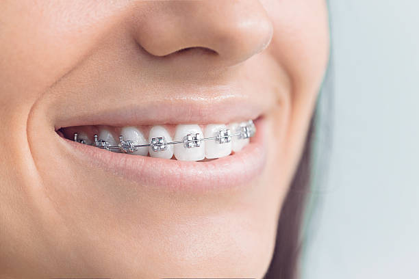 Best Veneers and Lumineers  in Caledonia, MI